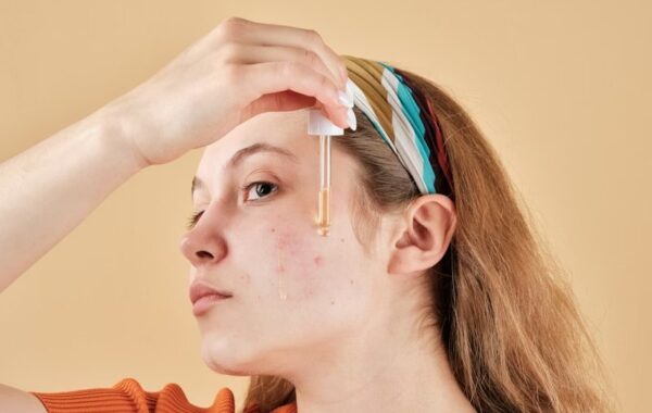 Acne Skin Breakout