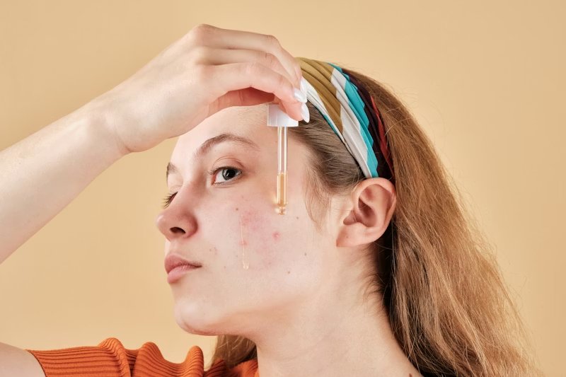Acne Skin Breakout