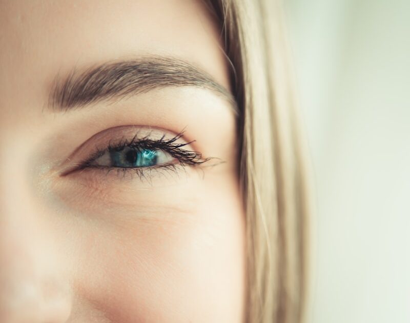 Azelaic Acid Skincare